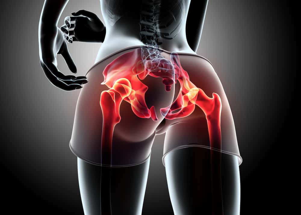 Snapping hip syndrome